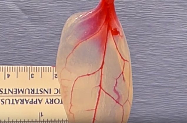 Hoja de espinaca convertida en tejido cardíaco