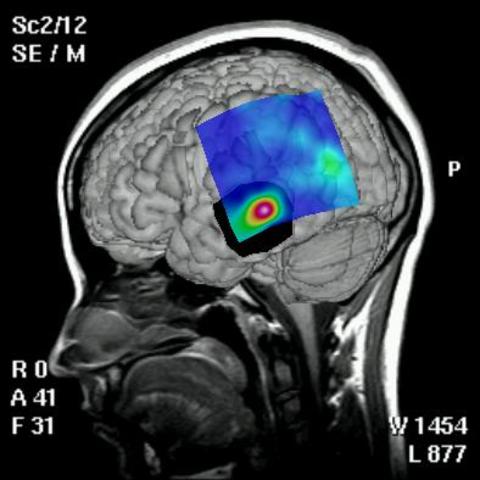 brother brain surgery