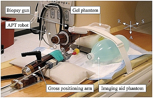 1985 Biópsia Robótica Assistida
