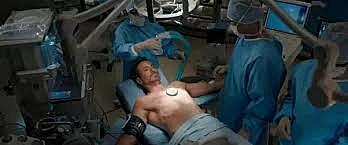 Removal of Arc Reactor