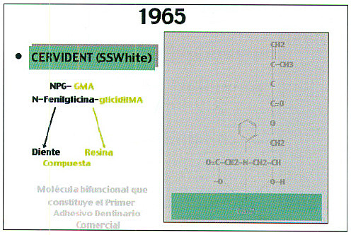 Primer Adhesivo Dentinario Comercial