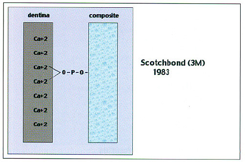 Scotchbond (3M)