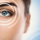 Lasik eye surgery