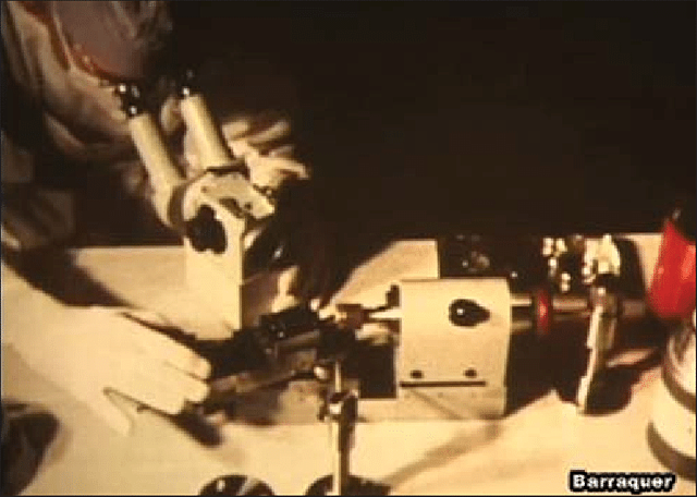 The contribution of Dr. Jose I. Barraquer Moner