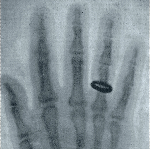 The discovery of X-rays