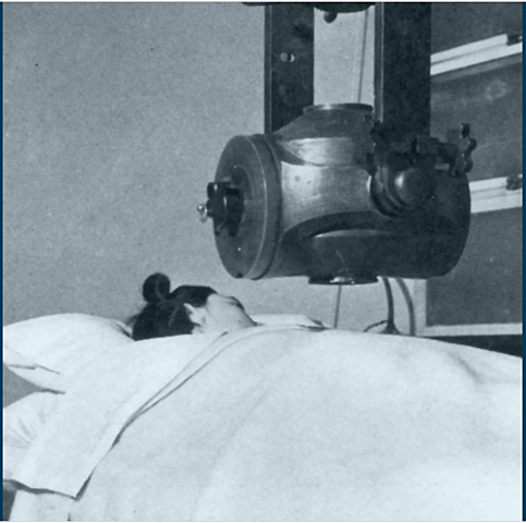 External beam radiation developed