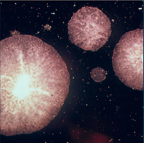 The tumor-suppressor gene, p53, is discovered