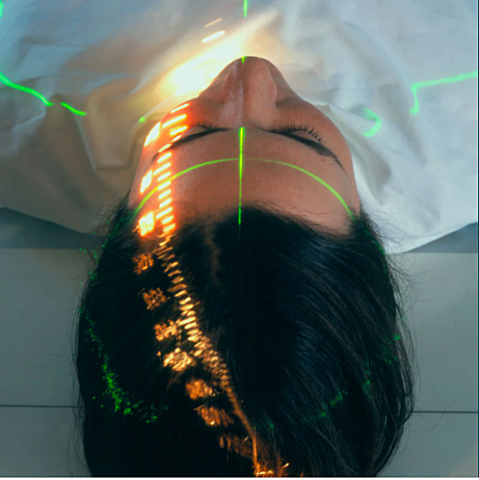 Stereotactic radiosurgery technique is developed