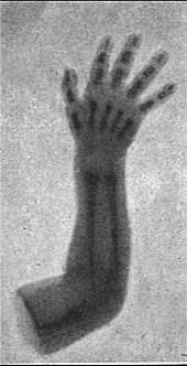 Se abren las puertas: primeras investigaciones