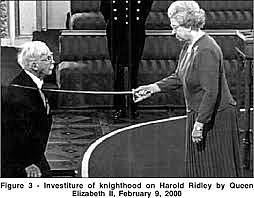 Lentes de acrilico intraoculare