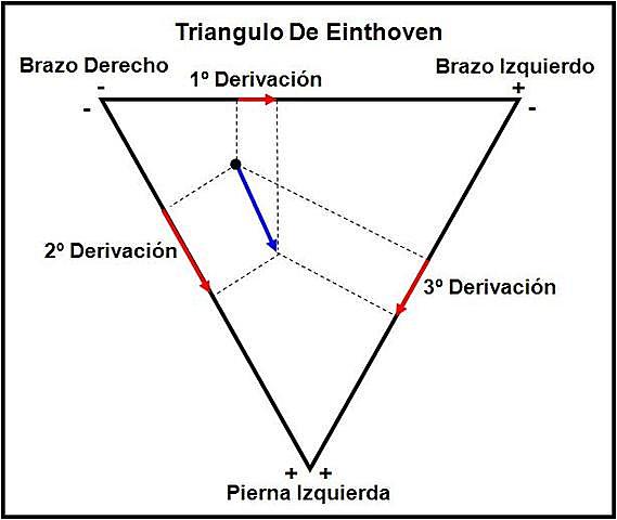 Triángulo de Einthoven