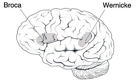 Siglo XIX Afasia de Wernicke