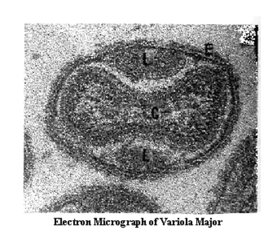 Disease Wipes out New England Indians