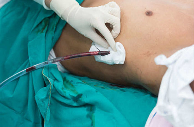 Ingreso a sala cuidados intermedios