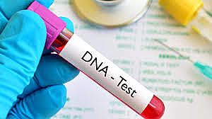 DNA Testing Developed