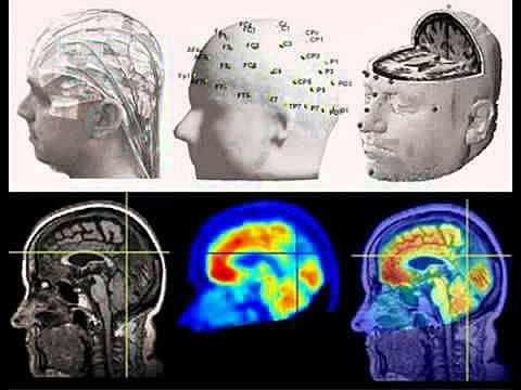 Neuropsicología dinámica