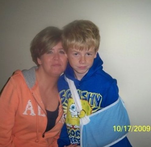 I broke my collar bone