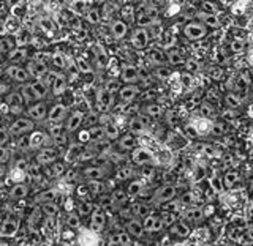 Human embryonic stem cell line established