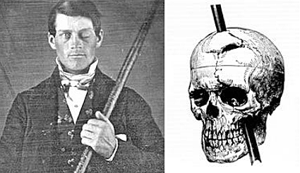 PHINEAS GAGE
