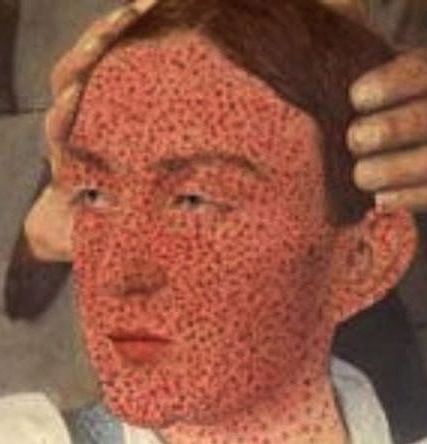 An epidemic of smallpox, brought by Europeans, kills many Native Americans on the New England coast.