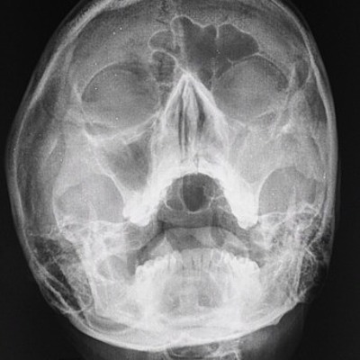 Timeline: Historia de los Rayos X