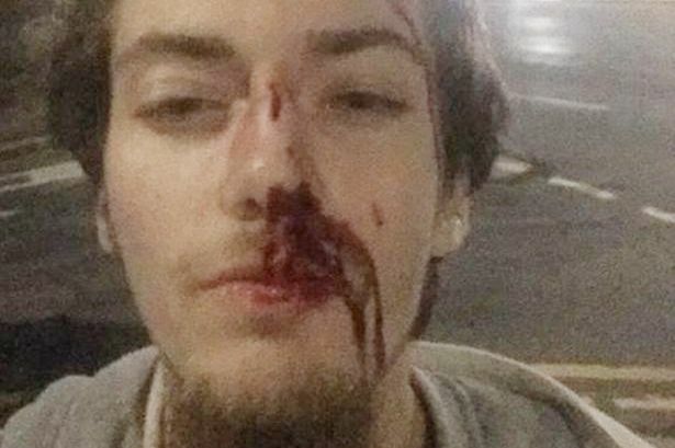 Greg Hospitalized After Mugging