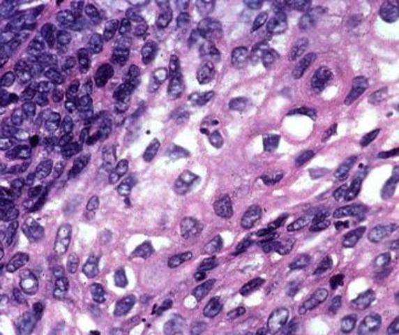 Earliest single-celled life appears on Earth