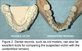 People were able to start using teeth to start identifying victims