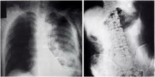 Reagan shot in chest