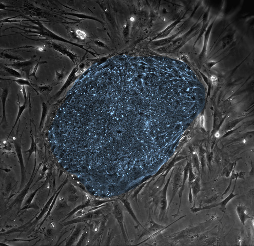 Human Embryonic Stem Cell Line Established