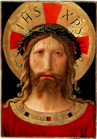 Conjuntivitis mística.