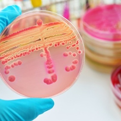 Timeline: Historia de La Microbiología                                          Por: Emma Portales Castañeda Carnet: 200-19-820