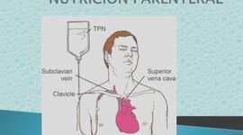 Timeline: Nutrición Parenteral