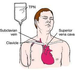 Principio de utilización de la NP