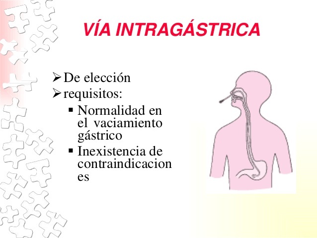 Método de alimentación intragástrica