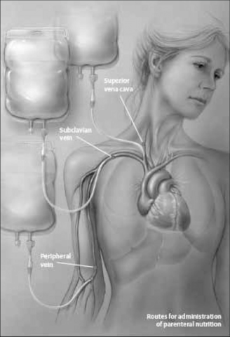 Primera administración intravenosa de una mezcla de aminoácidos cristalinos en humanos