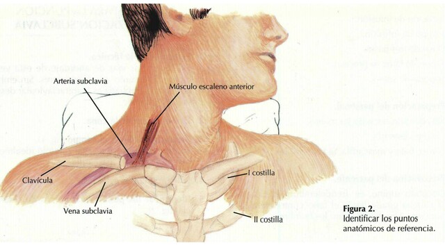 Uso de soluciones más concentradas.