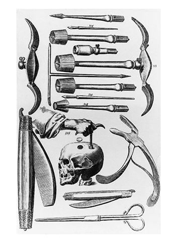 Headache? Depression? Demons??