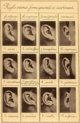 Sistema Otométrico de Frigerio, Francia