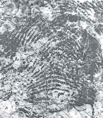 Salil Kumar Chatterjee de Calcuta, India, publicó el libro Finger, Palm, and Sole Prints pero Chatterjee es mejor conocido por su artículo “Edgeoscopy”