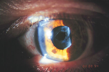 Juan Mauricio Capdevielle