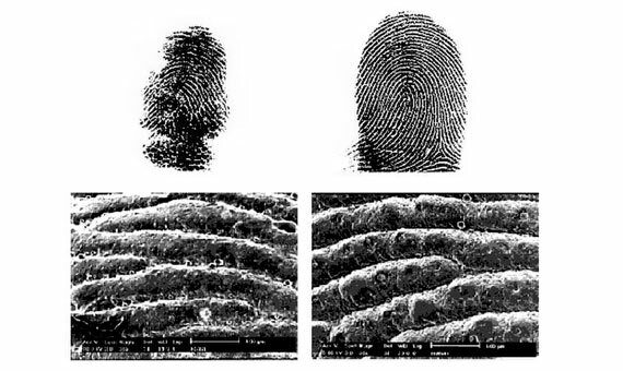 Henry Fornz, Reino Unido