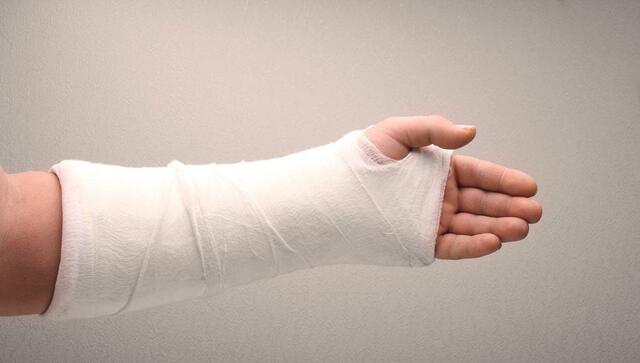 I broke my first bone