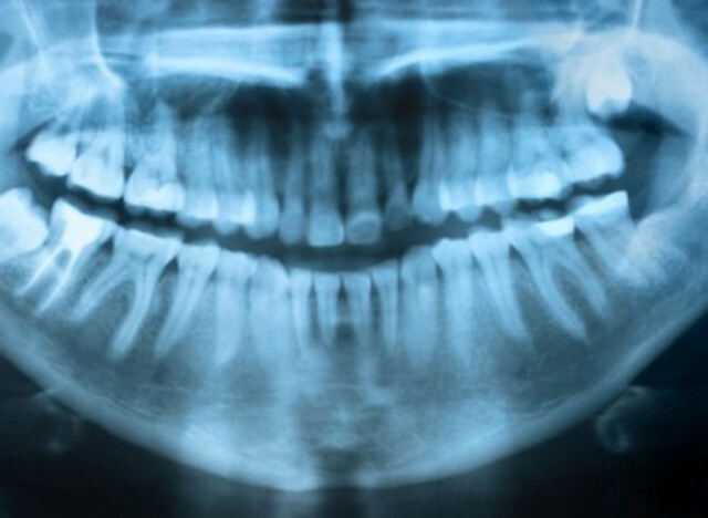 Using Dental Records