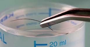 Rudolph Virchow studies hair & its limitations