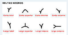 Descrubrimiento de Deltas