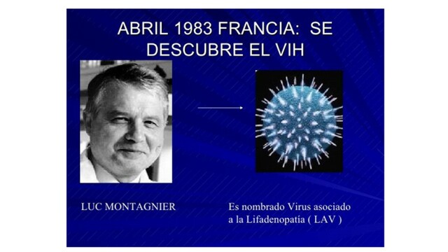 Determinan que el VIH es por Retrovirus