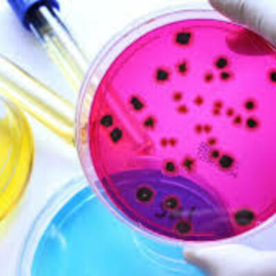 Timeline: Historia de la microbiología Por Gianni Garcia 200-18-76