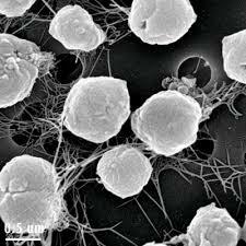 L'archeobatterio Methanocaldococcus jannaschii