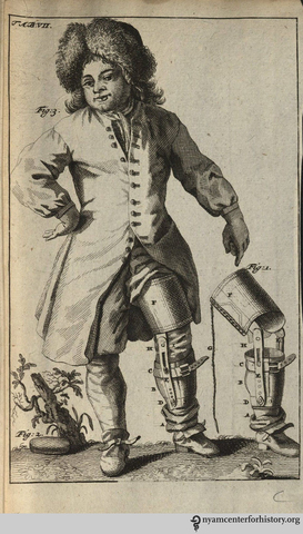 PRIMERA PRÓTESIS SIN MECANISMO DE BLOQUEO